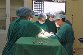 Đau mặt 1 bên không ngờ u tuyến mang tai chèn ép dây thần kinh mặt