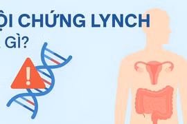 Phát hiện sớm hội chứng Lynch để ngăn ngừa ung thư 