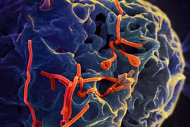 Ebola diễn biến phức tạp tại châu Phi, WHO cảnh báo khẩn 