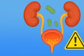 Nhiễm khuẩn tiết niệu, dấu hiệu nhỏ hậu quả lớn