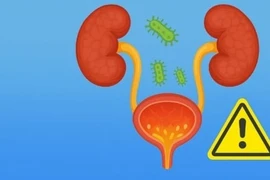 Nhiễm khuẩn tiết niệu, dấu hiệu nhỏ hậu quả lớn