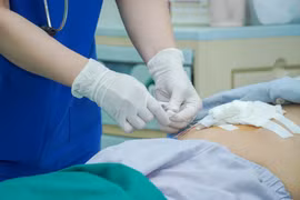 Khó thở, lồng ngực bị bóp nghẹt cần thận tràn dịch màng tim nguy kịch