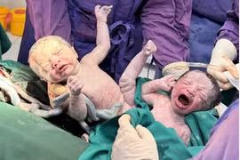 Cứu mẹ, bảo tồn hai thai nhi trong ca bệnh nguy cơ cao