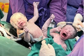 Cứu mẹ, bảo tồn hai thai nhi trong ca bệnh nguy cơ cao