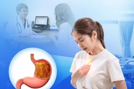Trào ngược dạ dày thực quản có thể tiến triển ung thư