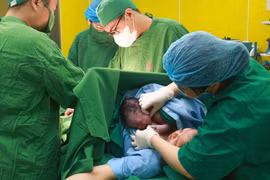 Mổ cấp cứu cho sản phụ thai to, ngôi mặt sẹo mổ cũ dính