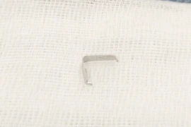 Bé 12 tháng tuổi hóc ghim tất vào họng, cảnh báo nguy cơ dị vật sắc nhọn