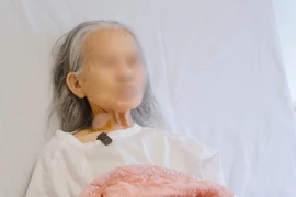 Cấp cứu thành công cụ bà 95 tuổi viêm túi mật hoại tử, nhiễm trùng nặng