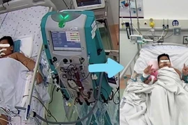 Cứu trẻ 7 tuổi sốt xuất huyết nguy kịch vì hội chứng thực bào máu