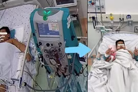 Cứu trẻ 7 tuổi sốt xuất huyết nguy kịch vì hội chứng thực bào máu