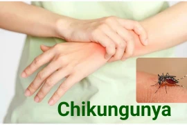 Nguy cơ Chikunguny xâm nhập vào Việt Nam, bác sĩ mách cách phát hiện sớm