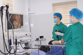 Nội soi phát hiện sớm ung thư đường tiêu hóa