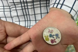 Đồng xu 2,5 cm mắc kẹt trong thực quản bé gái hơn 5 tuổi