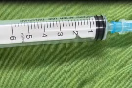 Hiếm gặp, sán ký sinh trong khối u vùng ổ bụng