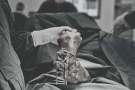 Vi phẫu nối lại cẳng tay đứt lìa cho nam bệnh nhân