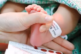 90% trẻ sơ sinh Hà Nội sàng lọc 5 bệnh bẩm sinh phổ biến