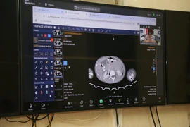 4 nạn nhân trong vụ lũ quét tại Điện Biên được Telemedicine hội chẩn cấp cứu