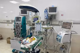 Lọc máu liên tục cứu trẻ sơ sinh sốc nhiễm khuẩn do thủng ruột, viêm phúc mạc