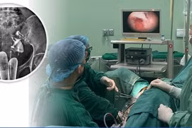 Tách dính buồng tử cung mang lại hy vọng cho người mẹ 10 năm mong con