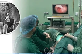 Tách dính buồng tử cung mang lại hy vọng cho người mẹ 10 năm mong con