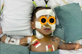 Tuần hoàn ngoài cơ thể cứu trẻ 8kg viêm phổi nặng do Adenovirus 