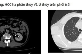 Vượt 1000 km người đàn ông Campuchia đến Việt Nam tìm thấy hy vọng sống