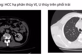 Vượt 1000 km người đàn ông Campuchia đến Việt Nam tìm thấy hy vọng sống
