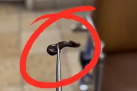 Bơi suối, chảy máu mũi, bé trai 4 tuổi nhập viện vì có vắt ký sinh trong mũi