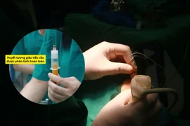 Cứu cánh tay “đông cứng” lâu năm cho người bệnh 51 tuổi