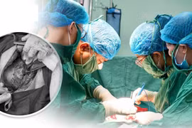 Rau cài răng lược, biến chứng sản khoa đe dọa sức khỏe mẹ con