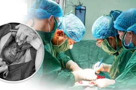 Rau cài răng lược, biến chứng sản khoa đe dọa sức khỏe mẹ con