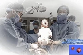 Lấy thai bóc u xơ tử cung cho sản phụ ngôi ngược