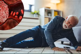 Nguy cơ chảy máu do chấn thương khi dùng thuốc chống huyết khối