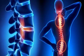 Địa chỉ vàng: Bệnh viện điều trị viêm tủy sống tại Hà Nội