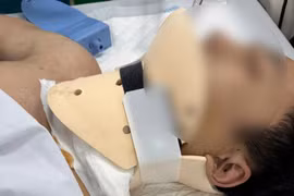 Thanh niên 20 tuổi hôn mê nguy kịch vì bị chém đứt mạch máu, thần kinh ở cổ