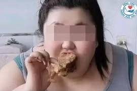 Trào lưu ăn uống trên mạng gây hậu quả sức khỏe nghiêm trọng