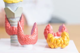 Rò dưỡng chấp sau mổ tuyến giáp gây ảnh hưởng nghiêm trọng