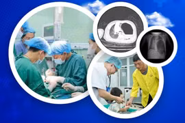 Ngã tại nhà, trẻ bị tràn máu, tràn khí màng phổi nguy kịch