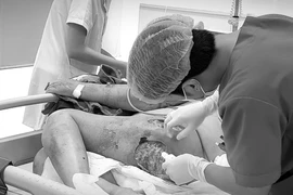 Tự chích mụn, cụ ông sốc nhiễm trùng huyết, hoại tử vùng mông đùi