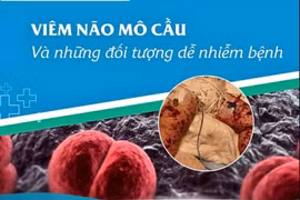 Viêm não mô cầu dấu hiệu giống cảm cúm, cách gì phân biệt?