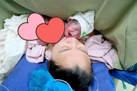 Hội chứng song thai không tim, bé gái chào đời khỏe mạnh