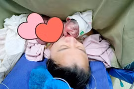 Hội chứng song thai không tim, bé gái chào đời khỏe mạnh