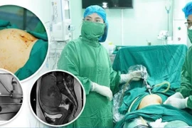 Nội soi bóc khối u xơ tử cung “khủng” cho bệnh nhân 24 tuổi
