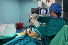 Bắt vít cột sống qua da cho người bệnh 59 tuổi bị vỡ đốt sống mất vững