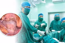 Treo tử cung vào dải chậu lược trị sa sinh dục