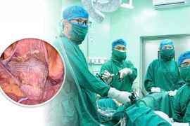 Treo tử cung vào dải chậu lược trị sa sinh dục