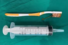 Nằm viện, thanh niên 33 tuổi nuốt cả bàn chải đánh răng vào bụng