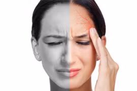 Động kinh, đột quỵ... vì bệnh đau đầu migraine