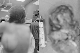 Loại bỏ khối u mỡ khổng lồ, giải phóng nỗi khổ 25 năm cho người bệnh