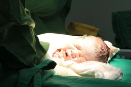 Lấy thai cho người mẹ ung thư vòm họng quyết giữ con đến giây phút cuối